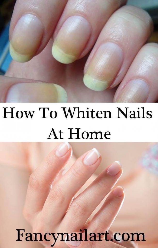 Whitening Nail Tips - How To Whiten Nails At Home