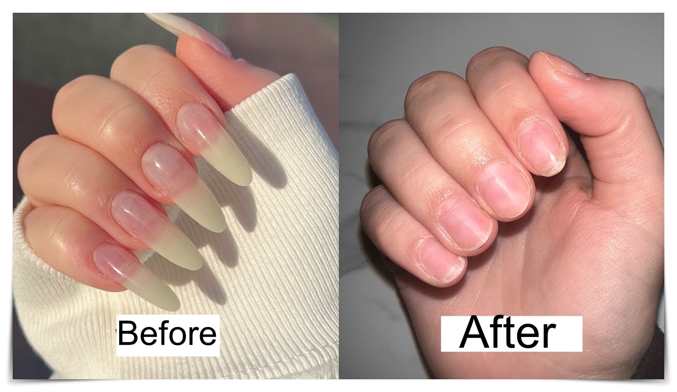 How To Remove Acrylic Nails At Home 3 steps